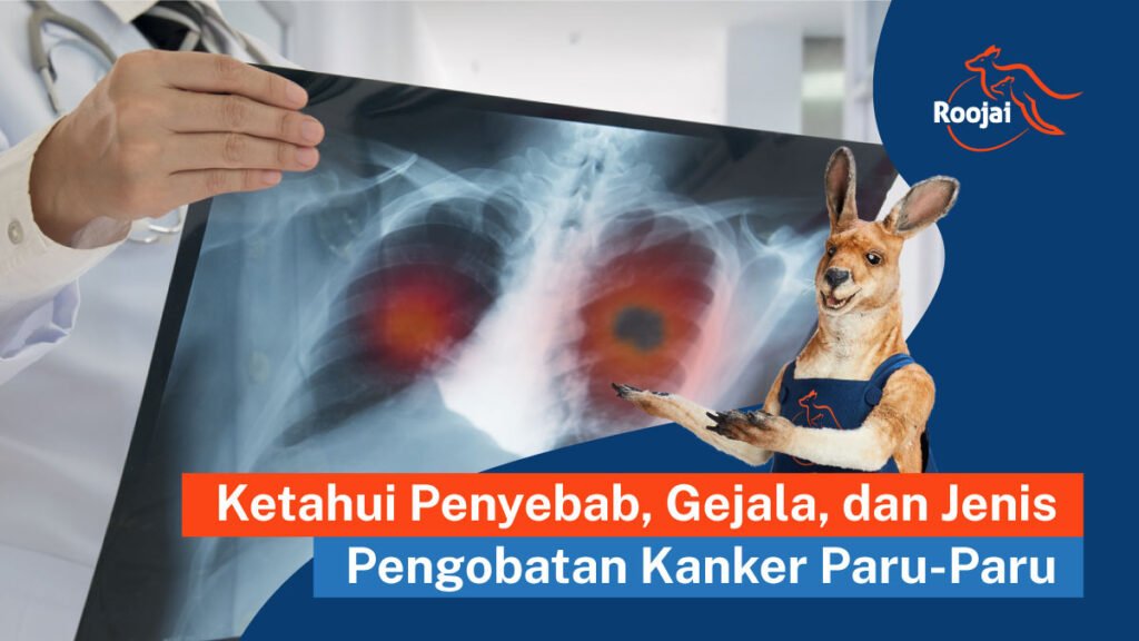 apa yang Menyebabkan kanker paru-paru bisa terjadi?